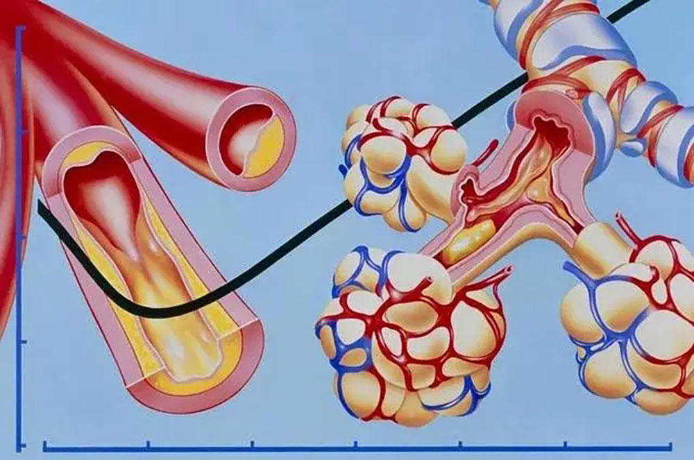 4种降压药尽量不要长期服用，医生：尽早换药。