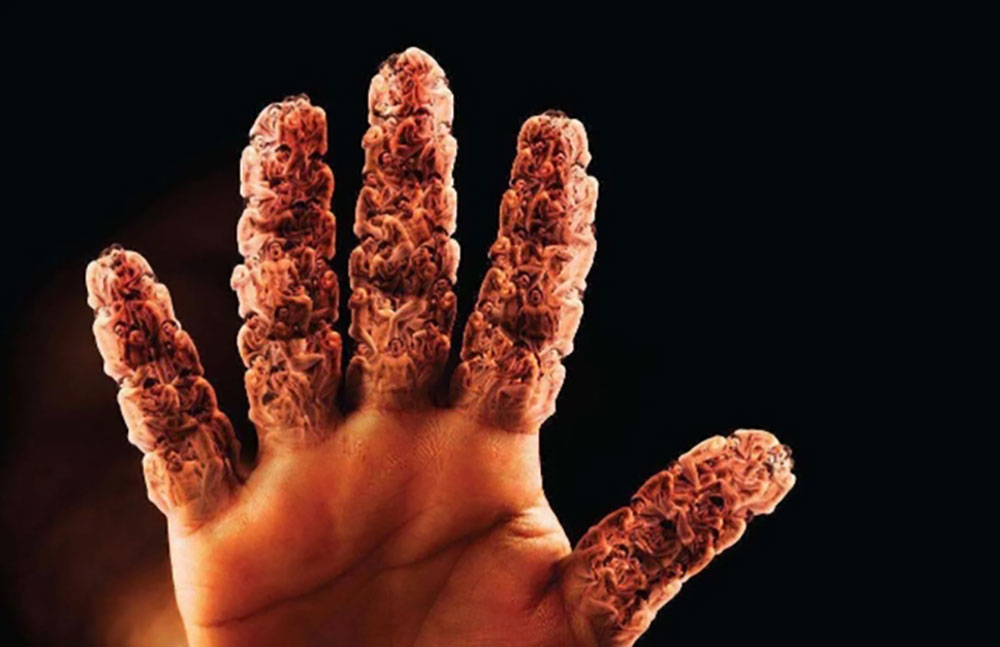 高尿酸不能吃羊肉？不想肾走“下坡路”，尽量远离这4物。