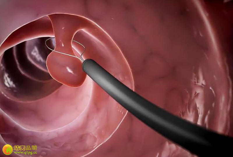 【冬季养胃】冬天吃萝卜对胃病有没有影响？