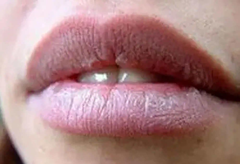 肝功能异常，或会出现“2痒，3黑”如果你有请尽早检查。